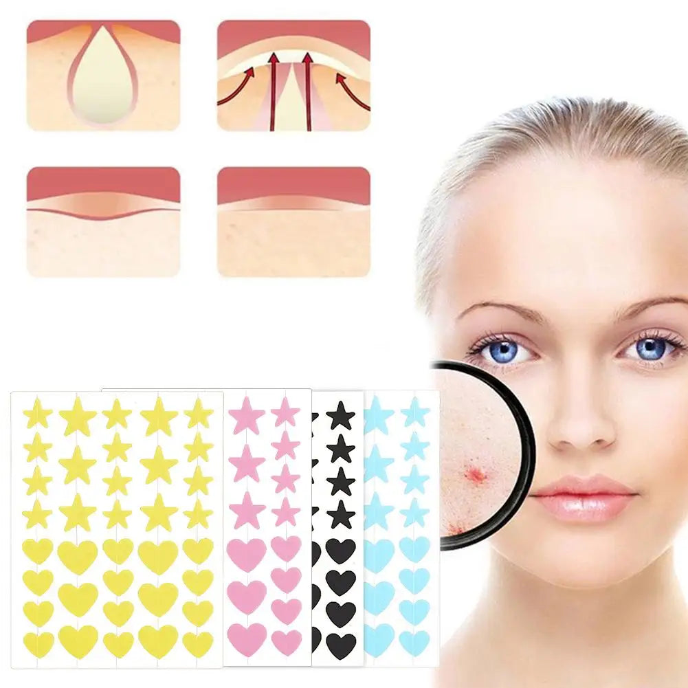 36PCS Star Pimple Patch Acne Colorful