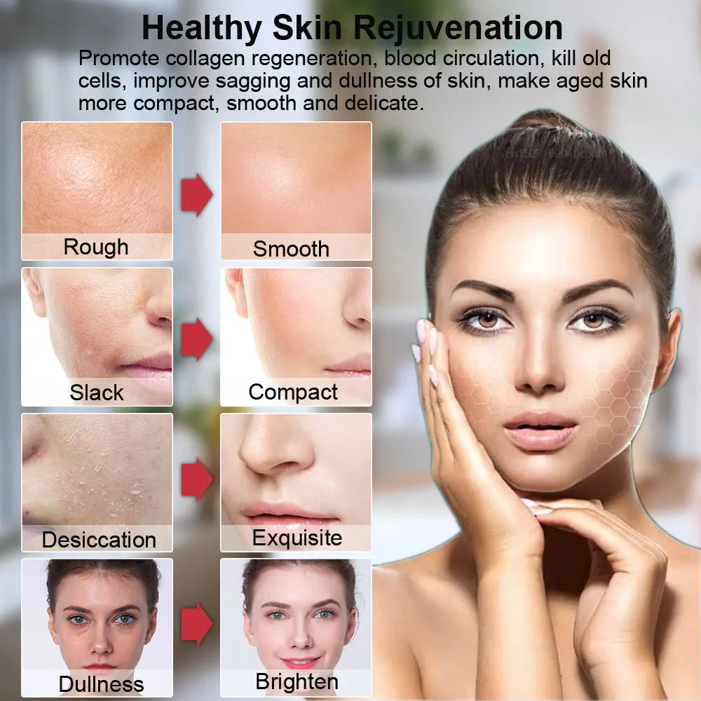 Face Lifting Facial Radio Frequency
