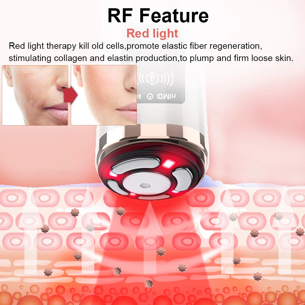 Face Lifting Facial Radio Frequency