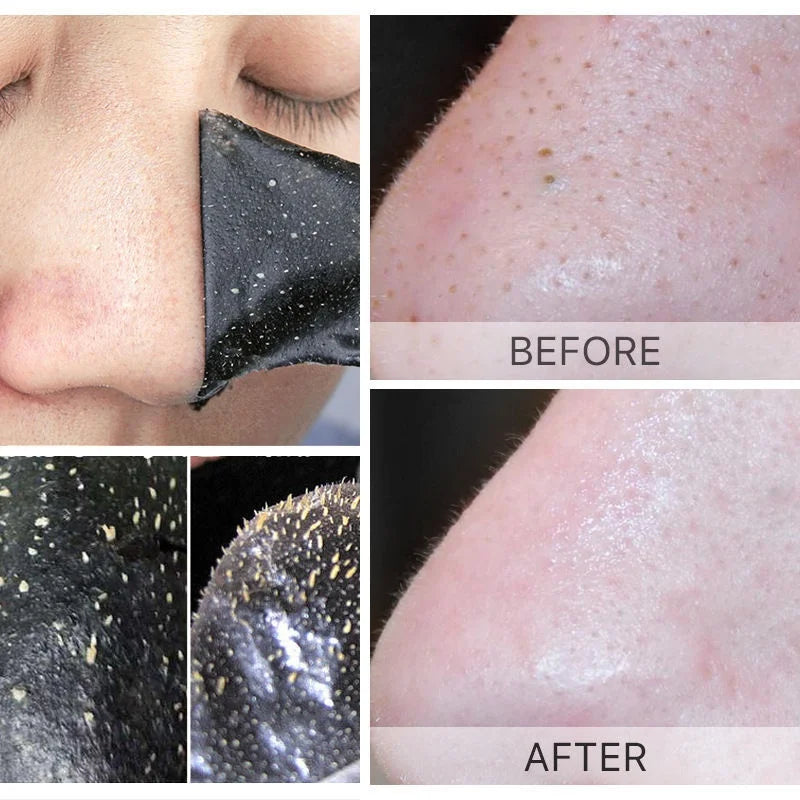 Blackhead Removal Mask Peel Deep Cleansing