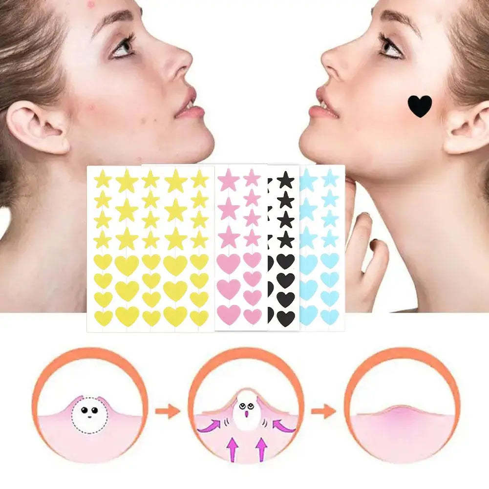 36PCS Star Pimple Patch Acne Colorful
