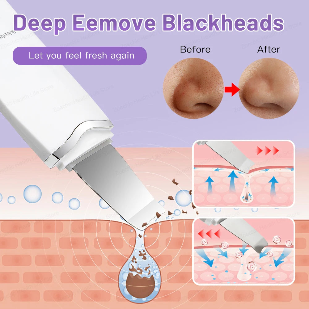Ultrasonic Skin Scrubber and Massager