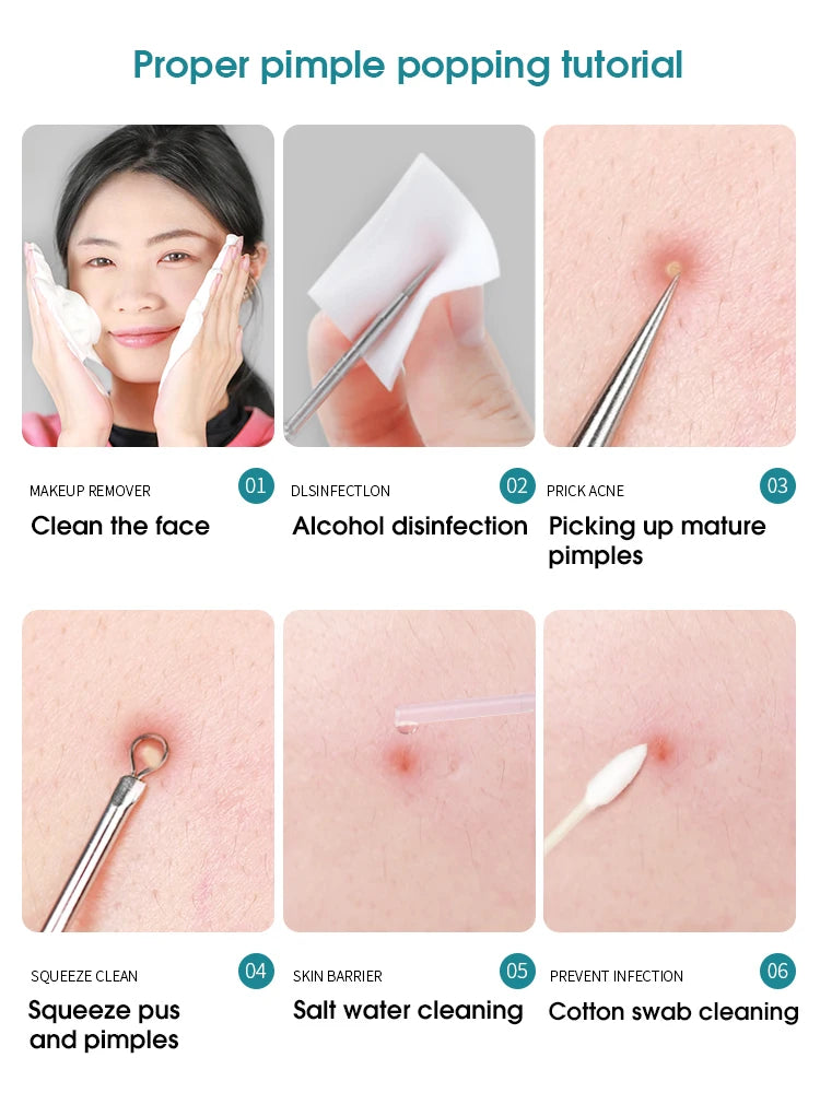 Super Pointed Cell Clip Acne Needle Set