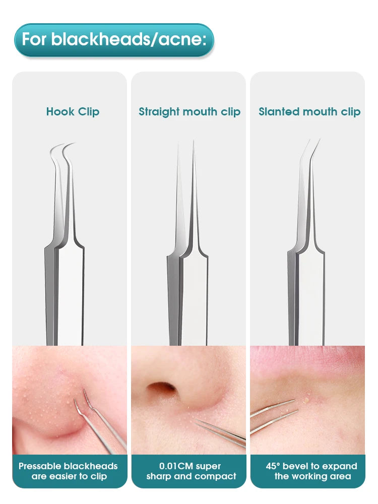 Super Pointed Cell Clip Acne Needle Set